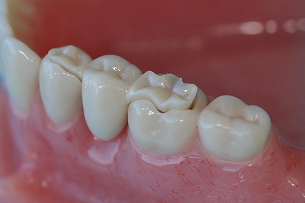 Tony Majdalany Dental Lab — 5