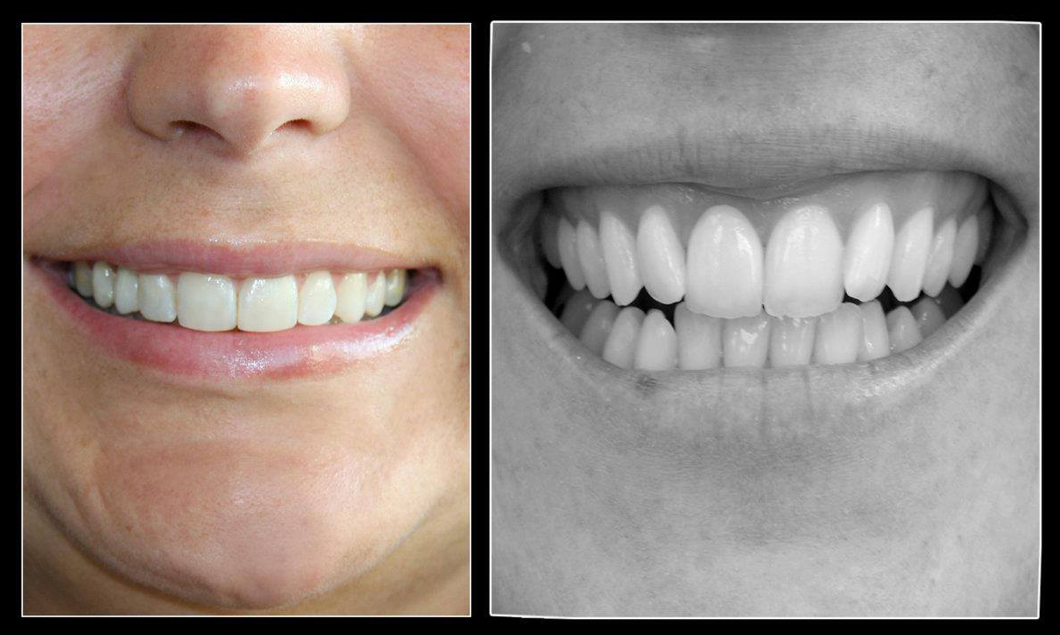 Tony Majdalany Dental Lab — 1